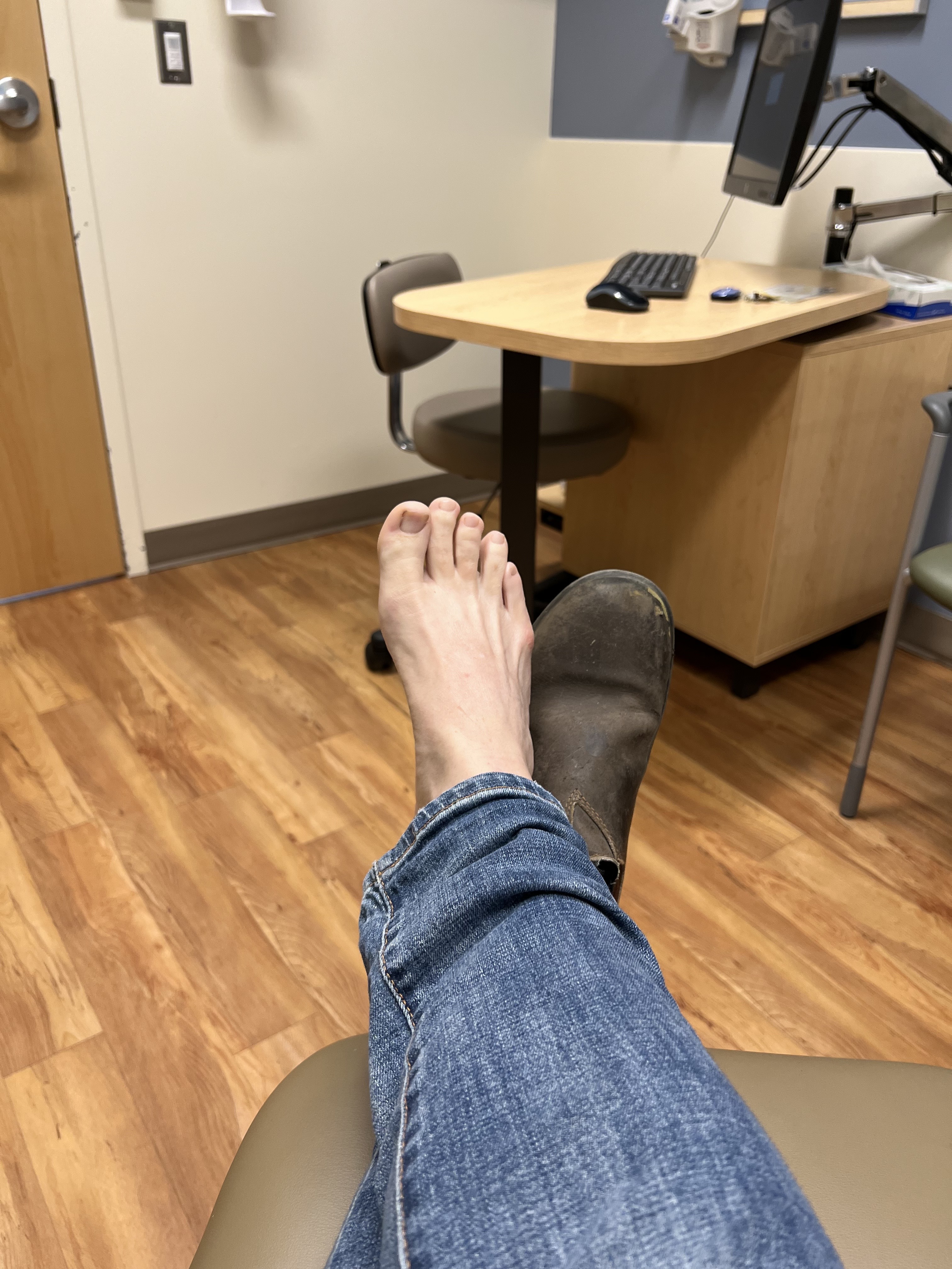 One bare foot, one boot, at a doctor office